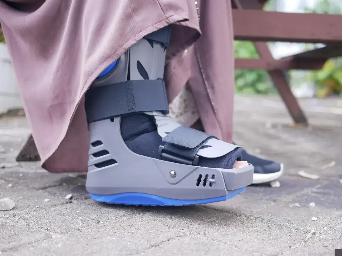 Buty ortopedyczne z pompowanym kołnierzem, noszone po złamaniu kości śródstopia, zapewniają stabilizację i komfort podczas rekonwalescencji.
